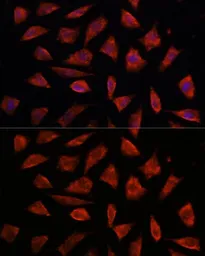 Anti-STAM2 antibody used in Immunocytochemistry/ Immunofluorescence (ICC/IF). GTX55808