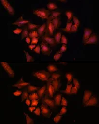 Anti-STAM2 antibody used in Immunocytochemistry/ Immunofluorescence (ICC/IF). GTX55808