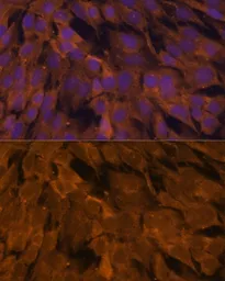 Anti-STAM2 antibody used in Immunocytochemistry/ Immunofluorescence (ICC/IF). GTX55808