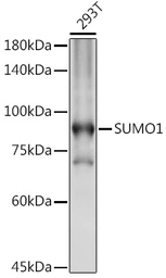 Anti-SUMO1 antibody used in Western Blot (WB). GTX55812