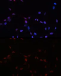 Anti-SUMO1 antibody used in Immunocytochemistry/ Immunofluorescence (ICC/IF). GTX55812