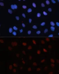 Anti-SUMO1 antibody used in Immunocytochemistry/ Immunofluorescence (ICC/IF). GTX55812