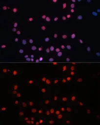 Anti-SUMO1 antibody used in Immunocytochemistry/ Immunofluorescence (ICC/IF). GTX55812