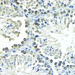 Anti-SUMO1 antibody used in IHC (Paraffin sections) (IHC-P). GTX55812