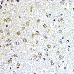 Anti-SUMO1 antibody used in IHC (Paraffin sections) (IHC-P). GTX55812
