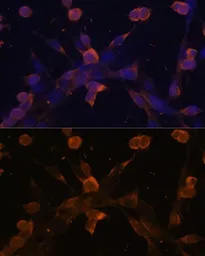 Anti-TGF beta Receptor 2 antibody used in Immunocytochemistry/ Immunofluorescence (ICC/IF). GTX55814