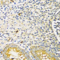 Anti-TGF beta Receptor 2 antibody used in IHC (Paraffin sections) (IHC-P). GTX55814