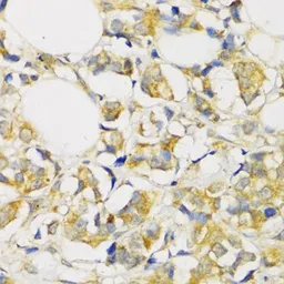 Anti-TGF beta Receptor 2 antibody used in IHC (Paraffin sections) (IHC-P). GTX55814