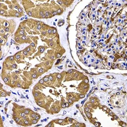 Anti-PIMT antibody used in IHC (Paraffin sections) (IHC-P). GTX55815