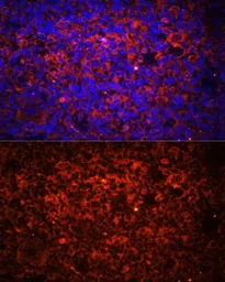 Anti-TLR8 antibody used in IHC (Paraffin sections) (IHC-P). GTX55817