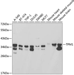 Anti-Tropomyosin 1 antibody used in Western Blot (WB). GTX55822