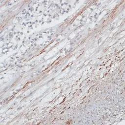 Anti-Tropomyosin 1 antibody used in IHC (Paraffin sections) (IHC-P). GTX55822