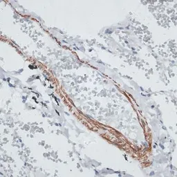 Anti-Tropomyosin 1 antibody used in IHC (Paraffin sections) (IHC-P). GTX55822