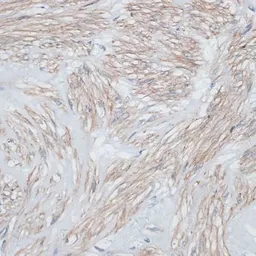 Anti-Tropomyosin 1 antibody used in IHC (Paraffin sections) (IHC-P). GTX55822