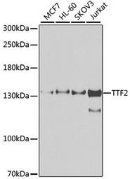 Anti-TTF2 antibody used in Western Blot (WB). GTX55824