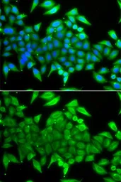Anti-TTF2 antibody used in Immunocytochemistry/ Immunofluorescence (ICC/IF). GTX55824