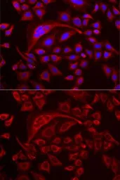 Anti-TUFM antibody used in Immunocytochemistry/ Immunofluorescence (ICC/IF). GTX55825