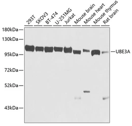 Anti-UBE3A antibody used in Western Blot (WB). GTX55832