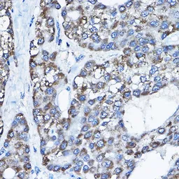 Anti-UBE3A antibody used in IHC (Paraffin sections) (IHC-P). GTX55832