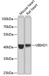 Anti-UBIAD1 antibody used in Western Blot (WB). GTX55833
