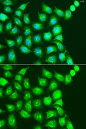 Anti-UBIAD1 antibody used in Immunocytochemistry/ Immunofluorescence (ICC/IF). GTX55833