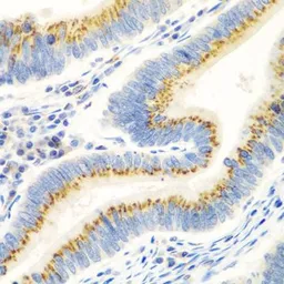 Anti-UBIAD1 antibody used in IHC (Paraffin sections) (IHC-P). GTX55833