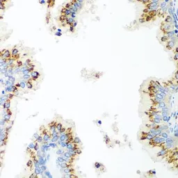 Anti-UBIAD1 antibody used in IHC (Paraffin sections) (IHC-P). GTX55833
