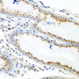 Anti-UBIAD1 antibody used in IHC (Paraffin sections) (IHC-P). GTX55833