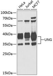 Anti-UNG antibody used in Western Blot (WB). GTX55836