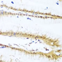 Anti-UNG antibody used in IHC (Paraffin sections) (IHC-P). GTX55836