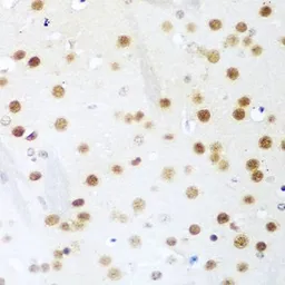 Anti-UNG antibody used in IHC (Paraffin sections) (IHC-P). GTX55836