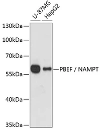 Anti-Visfatin antibody used in Western Blot (WB). GTX55840
