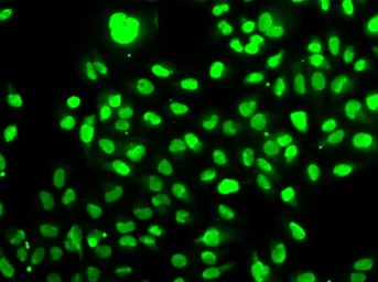 Anti-Visfatin antibody used in Immunocytochemistry/ Immunofluorescence (ICC/IF). GTX55840