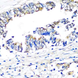 Anti-Visfatin antibody used in IHC (Paraffin sections) (IHC-P). GTX55840