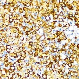 Anti-Visfatin antibody used in IHC (Paraffin sections) (IHC-P). GTX55840