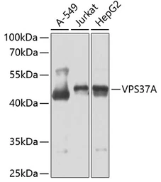 Anti-VPS37A antibody used in Western Blot (WB). GTX55841