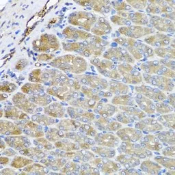 Anti-VPS37A antibody used in IHC (Paraffin sections) (IHC-P). GTX55841