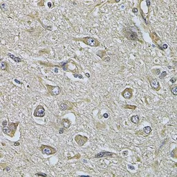 Anti-WIPI1 antibody used in IHC (Paraffin sections) (IHC-P). GTX55842