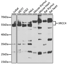 Anti-XRCC4 antibody used in Western Blot (WB). GTX55846