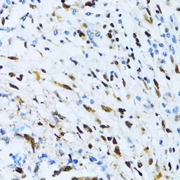 Anti-XRCC4 antibody used in Immunocytochemistry/ Immunofluorescence (ICC/IF). GTX55846