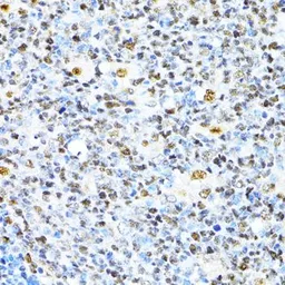 Anti-XRCC4 antibody used in IHC (Paraffin sections) (IHC-P). GTX55846