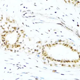 Anti-XRCC4 antibody used in IHC (Paraffin sections) (IHC-P). GTX55846