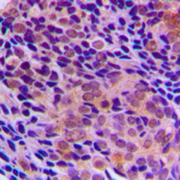 Anti-RagA/B antibody used in IHC (Paraffin sections) (IHC-P). GTX55848