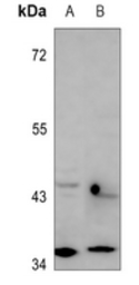 Anti-RagA/B antibody used in Western Blot (WB). GTX55848