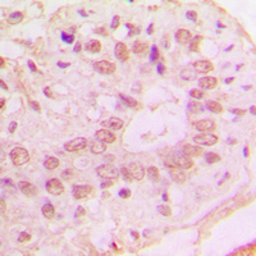 Anti-p15 INK4b antibody used in IHC (Paraffin sections) (IHC-P). GTX55855