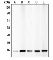 Anti-p15 INK4b antibody used in Western Blot (WB). GTX55855