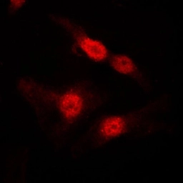 Anti-DGKA antibody used in Immunocytochemistry/ Immunofluorescence (ICC/IF). GTX55856