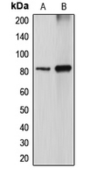 Anti-DGKA antibody used in Western Blot (WB). GTX55856