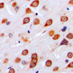 Anti-mGluR4 antibody used in IHC (Paraffin sections) (IHC-P). GTX55859