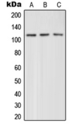 Anti-mGluR4 antibody used in Western Blot (WB). GTX55859